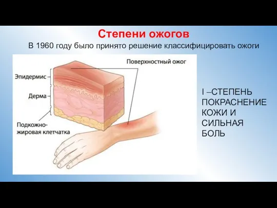 Степени ожогов В 1960 году было принято решение классифицировать ожоги I –СТЕПЕНЬ