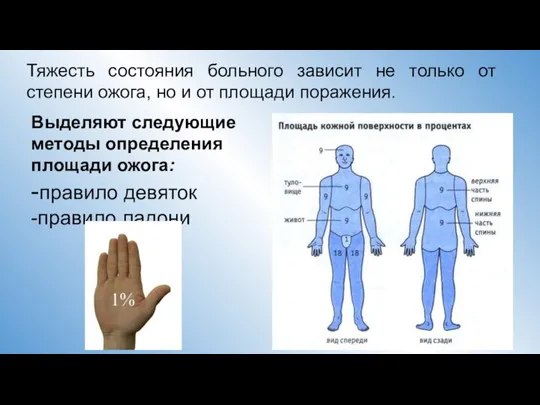 Тяжесть состояния больного зависит не только от степени ожога, но и от