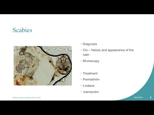 Scabies Diagnosis Clx – history and appearance of the rash Microscopy Treatment
