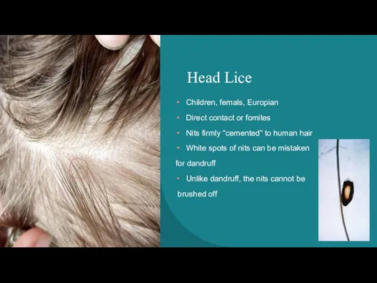 Head Lice Children, femals, Europian Direct contact or fomites Nits firmly “cemented”
