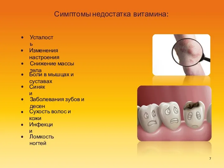 Симптомы недостатка витамина: Сухость волос и кожи Усталость Инфекции Изменения настроения Снижение