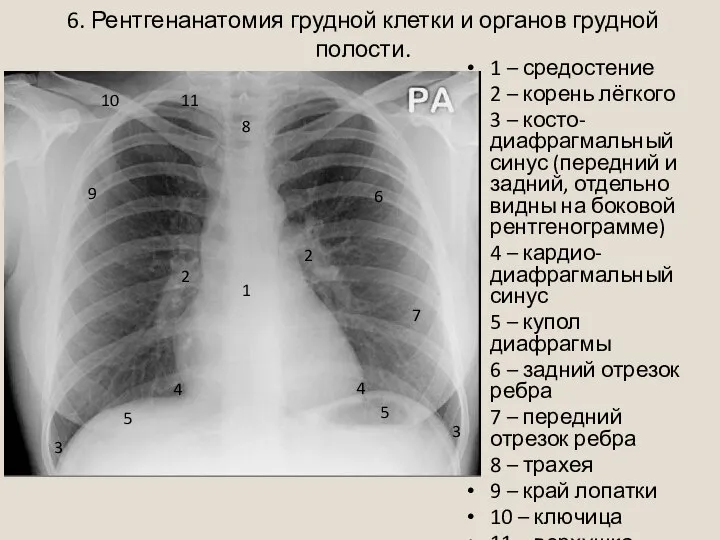 6. Рентгенанатомия грудной клетки и органов грудной полости. 1 – средостение 2
