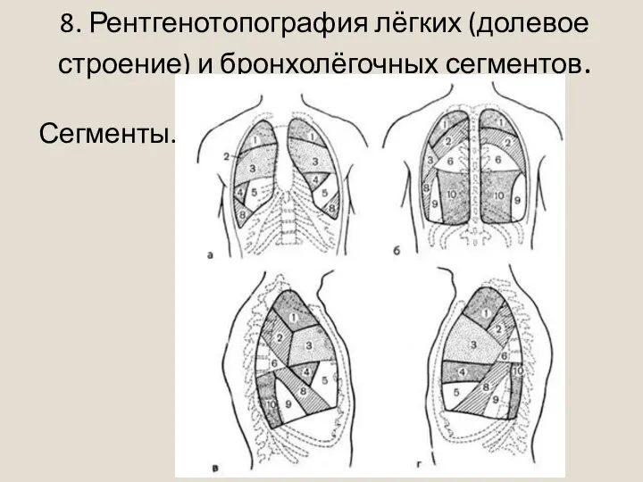 8. Рентгенотопография лёгких (долевое строение) и бронхолёгочных сегментов. Сегменты.
