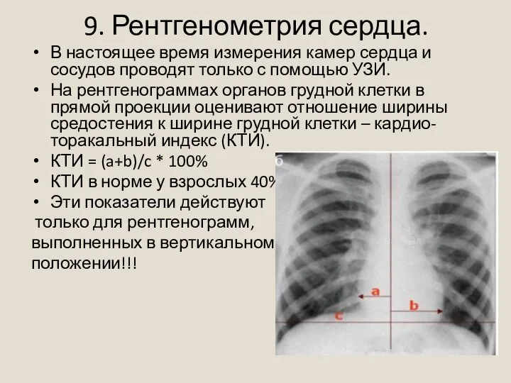 9. Рентгенометрия сердца. В настоящее время измерения камер сердца и сосудов проводят