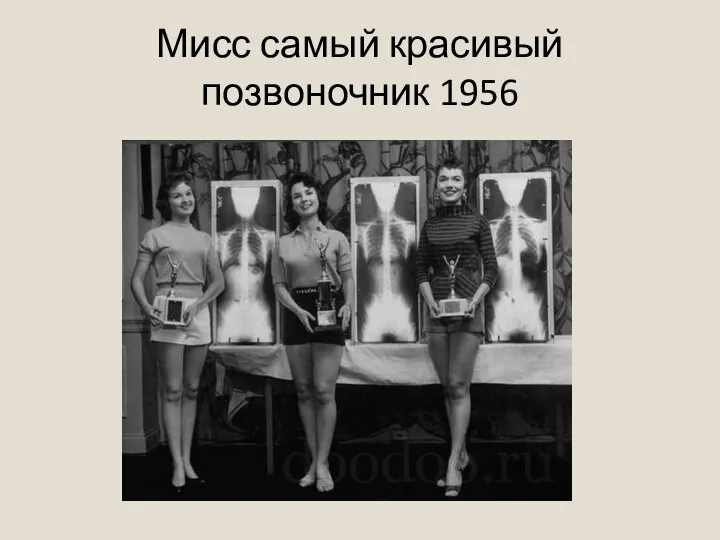 Мисс самый красивый позвоночник 1956