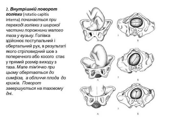 2. Внутрiшнiй поворот голiвки (rotatio capitis interna) починається при переходi голiвки з