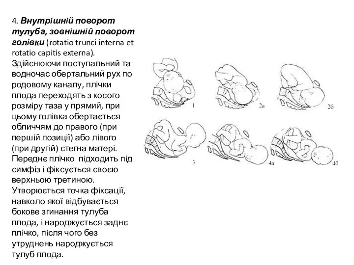 4. Внутрiшнiй поворот тулуба, зовнiшнiй поворот голiвки (rotatio trunci interna et rotatio