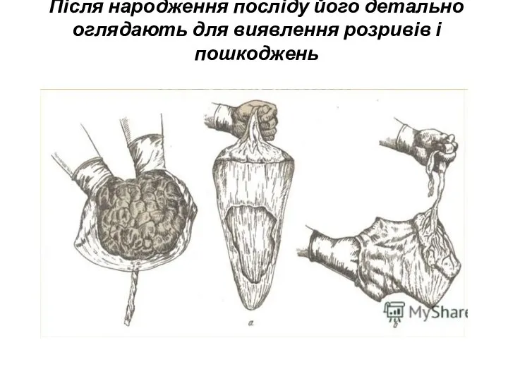 Після народження посліду його детально оглядають для виявлення розривів і пошкоджень