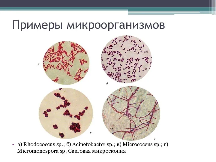 Примеры микроорганизмов а) Rhodococcus sp.; б) Acinetobacter sp.; в) Micrococcus sp.; г) Micromonospora sp. Световая микроскопия