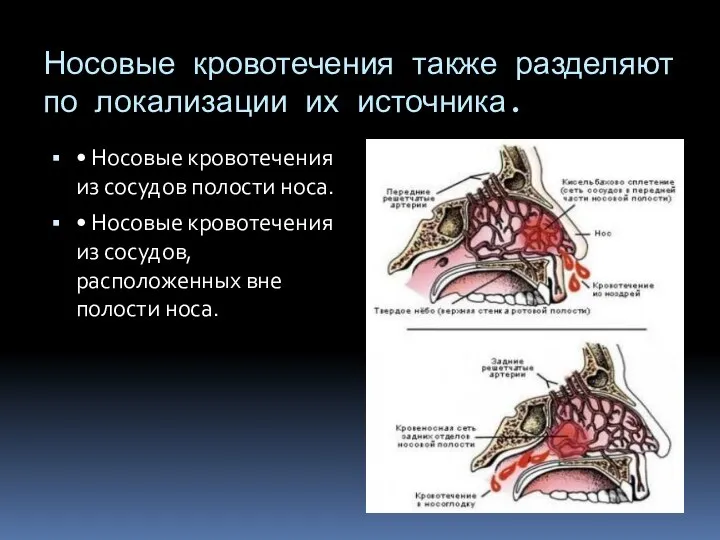 Носовые кровотечения также разделяют по локализации их источника. • Носовые кровотечения из