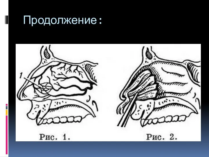 Продолжение: