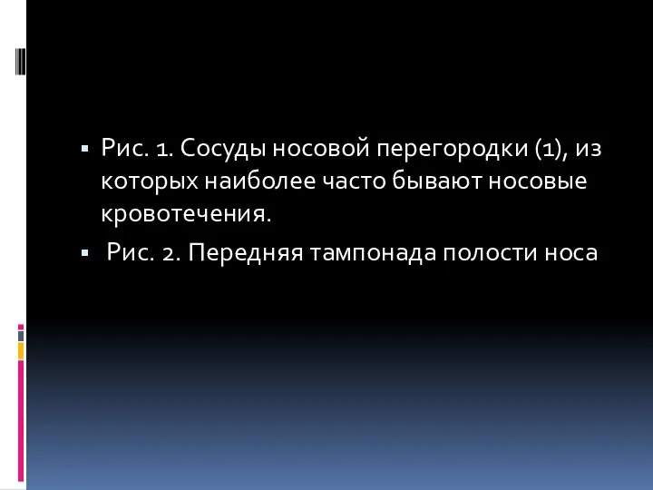 Рис. 1. Сосуды носовой перегородки (1), из которых наиболее часто бывают носовые