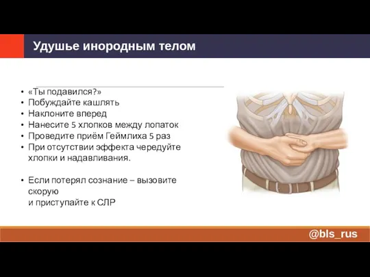 «Ты подавился?» Побуждайте кашлять Наклоните вперед Нанесите 5 хлопков между лопаток Проведите