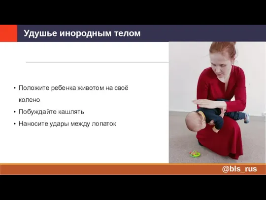 Удушье инородным телом @bls_rus Положите ребенка животом на своё колено Побуждайте кашлять Наносите удары между лопаток