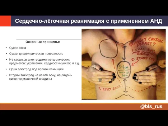 Основные принципы: Сухая кожа Сухая диэлектрическая поверхность Не касаться электродами металлических предметов: