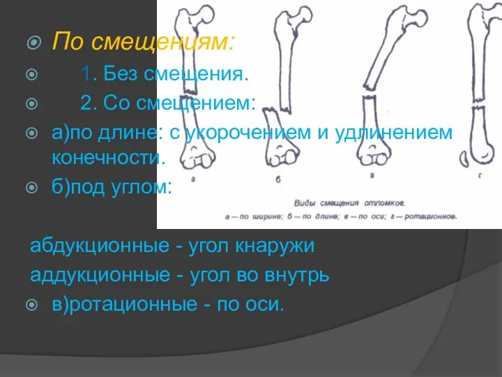 По смещениям: 1. Без смещения. 2. Со смещением: а)по длине: с укорочением