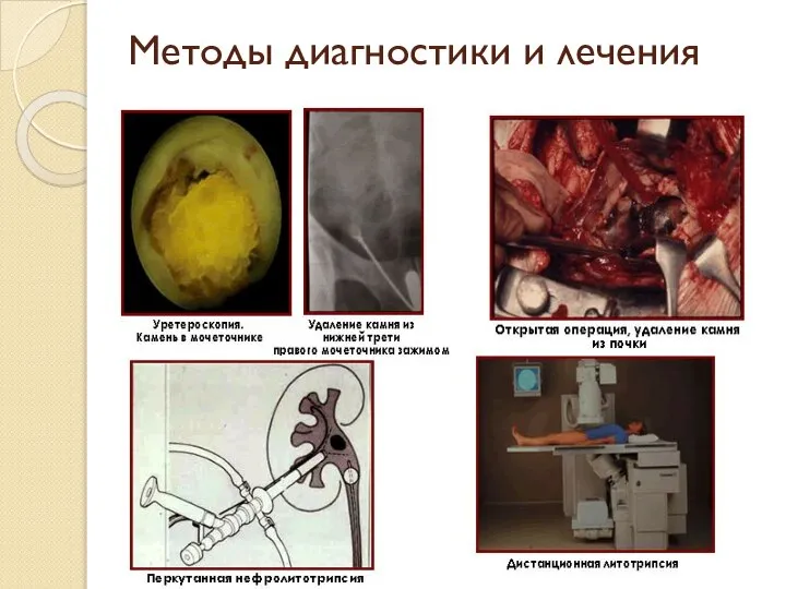 Методы диагностики и лечения