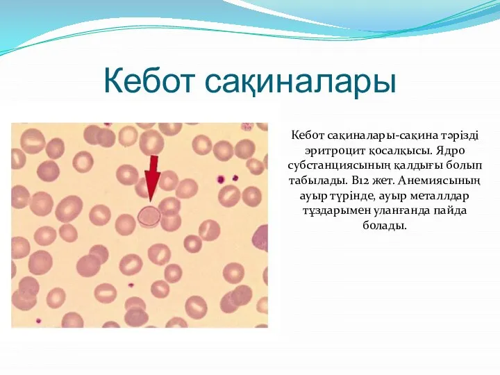 Кебот сақиналары Кебот сақиналары-сақина тәрізді эритроцит қосалқысы. Ядро субстанциясының қалдығы болып табылады.