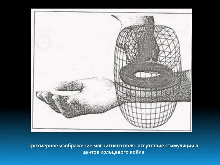 Трехмерное изображение магнитного поля: отсутствие стимуляции в центре кольцевого койла