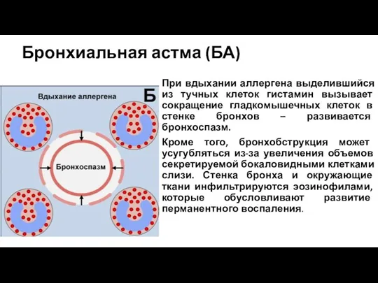 Бронхиальная астма (БА) При вдыхании аллергена выделившийся из тучных клеток гистамин вызывает