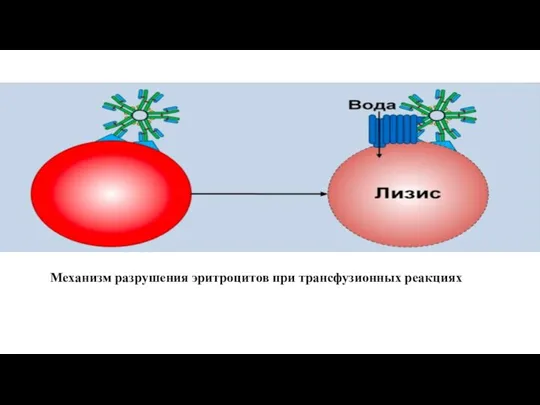 Механизм разрушения эритроцитов при трансфузионных реакциях