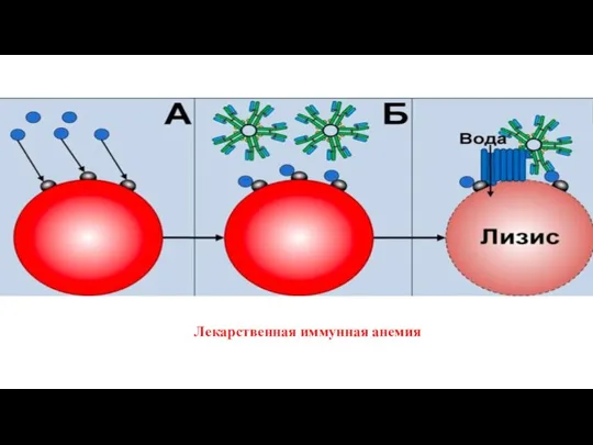 Лекарственная иммунная анемия