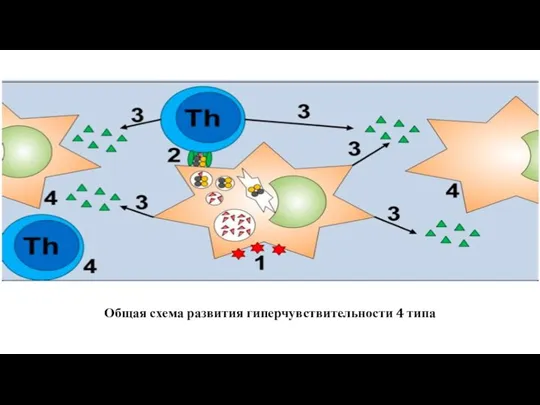 Общая схема развития гиперчувствительности 4 типа