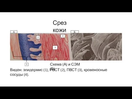 Срез кожи Схема (А) и СЭМ (Б) Виден: эпидермис (1), РВСТ (2),