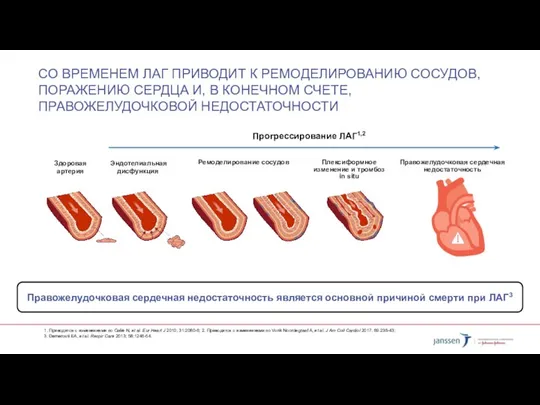 СО ВРЕМЕНЕМ ЛАГ ПРИВОДИТ К РЕМОДЕЛИРОВАНИЮ СОСУДОВ, ПОРАЖЕНИЮ СЕРДЦА И, В КОНЕЧНОМ