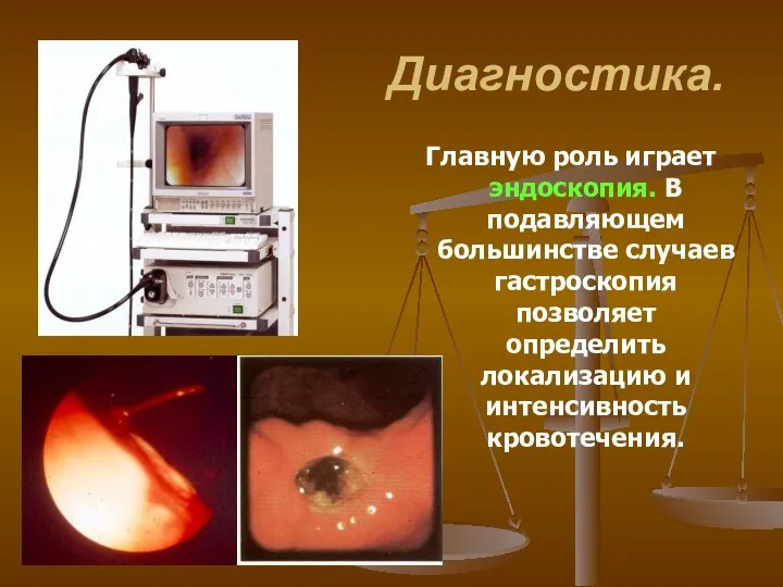 Диагностика. Главную роль играет эндоскопия. В подавляющем большинстве случаев гастроскопия позволяет определить локализацию и интенсивность кровотечения.