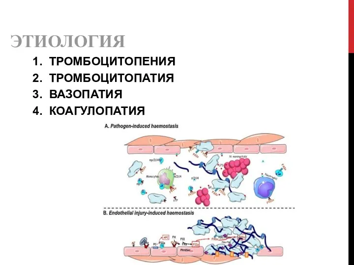 ЭТИОЛОГИЯ 1. ТРОМБОЦИТОПЕНИЯ 2. ТРОМБОЦИТОПАТИЯ 3. ВАЗОПАТИЯ 4. КОАГУЛОПАТИЯ