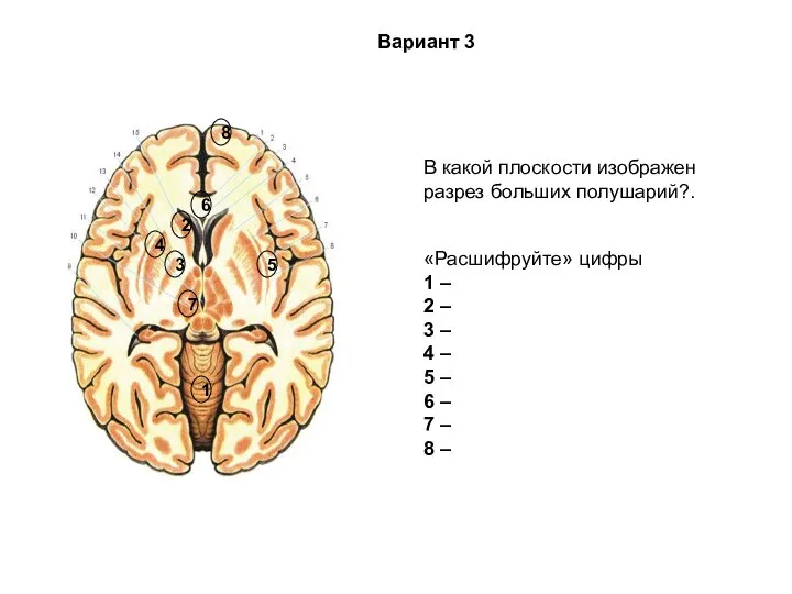 В какой плоскости изображен разрез больших полушарий?. «Расшифруйте» цифры 1 – 2