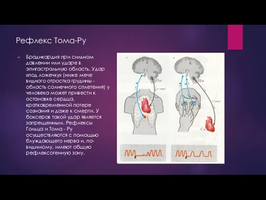 Рефлекс Тома-Ру Брадикардия при сильном давлении или ударе в эпигастральную область. Удар