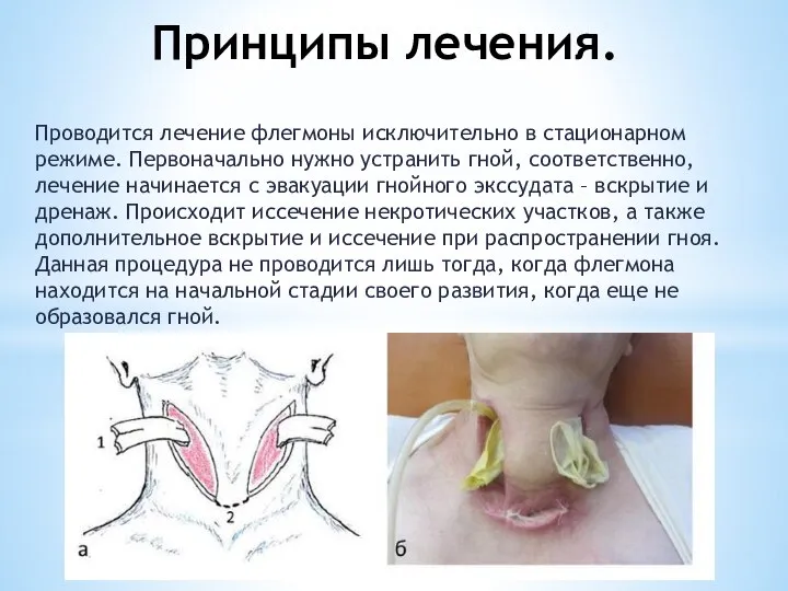 Принципы лечения. Проводится лечение флегмоны исключительно в стационарном режиме. Первоначально нужно устранить