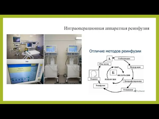 Интраоперационная аппаратная реинфузия