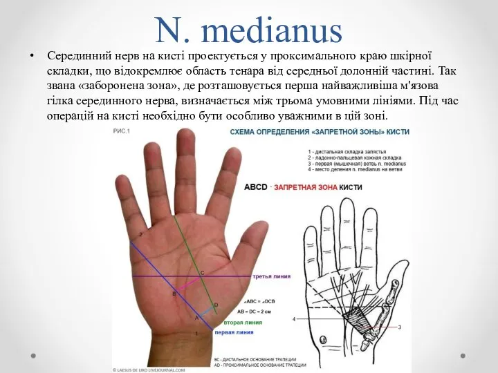 N. medianus Серединний нерв на кисті проектується у проксимального краю шкірної складки,