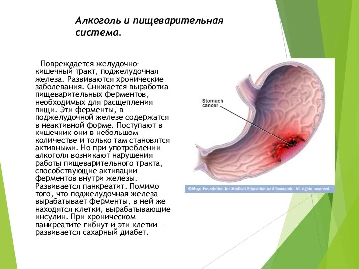 Алкоголь и пищеварительная система. Повреждается желудочно-кишечный тракт, поджелудочная железа. Развиваются хронические заболевания.