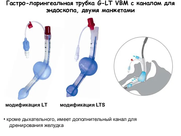 Гастро-ларингеальная трубка G-LT VBM с каналом для эндоскопа, двумя манжетами модификация LT