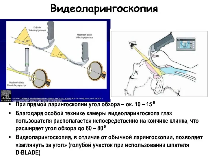 Видеоларингоскопия При прямой ларингоскопии угол обзора – ок. 10 – 15 0