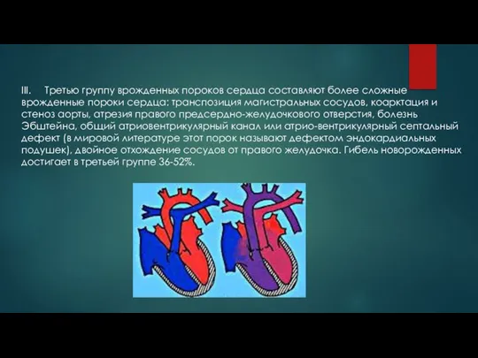 III. Третью группу врожденных пороков сердца составляют более сложные врожденные пороки сердца: