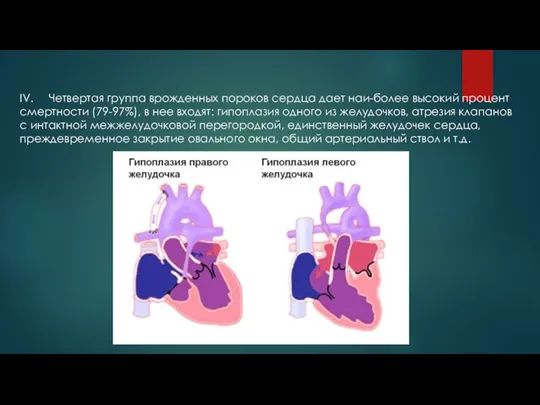 IV. Четвертая группа врожденных пороков сердца дает наи-более высокий процент смертности (79-97%),
