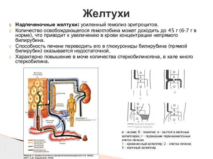 Надпеченочные желтухи: усиленный гемолиз эритроцитов. Количество освобождающегося гемоглобина может доходить до 45