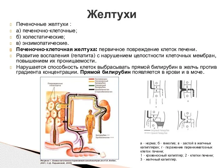 Печеночные желтухи : а) печеночно-клеточные; б) холестатические; в) энзимопатические. Печеночно-клеточная желтуха: первичное