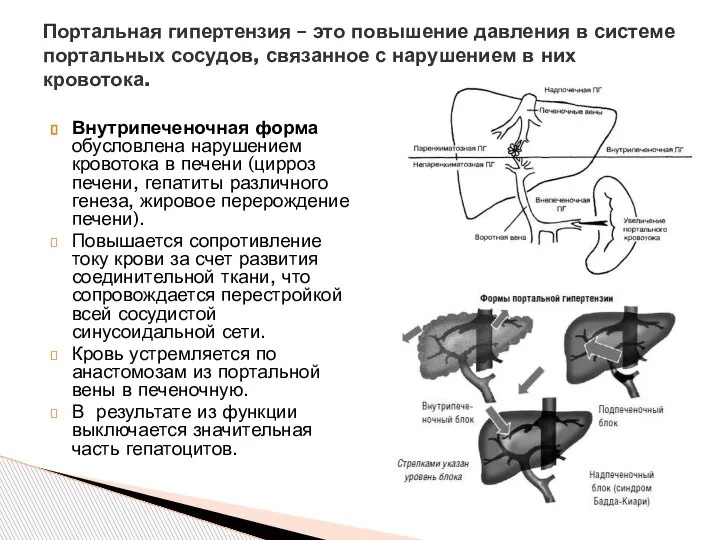 Внутрипеченочная форма обусловлена нарушением кровотока в печени (цирроз печени, гепатиты различного генеза,