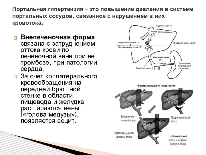 Внепеченочная форма связана с затруднением оттока крови по печеночной вене при ее