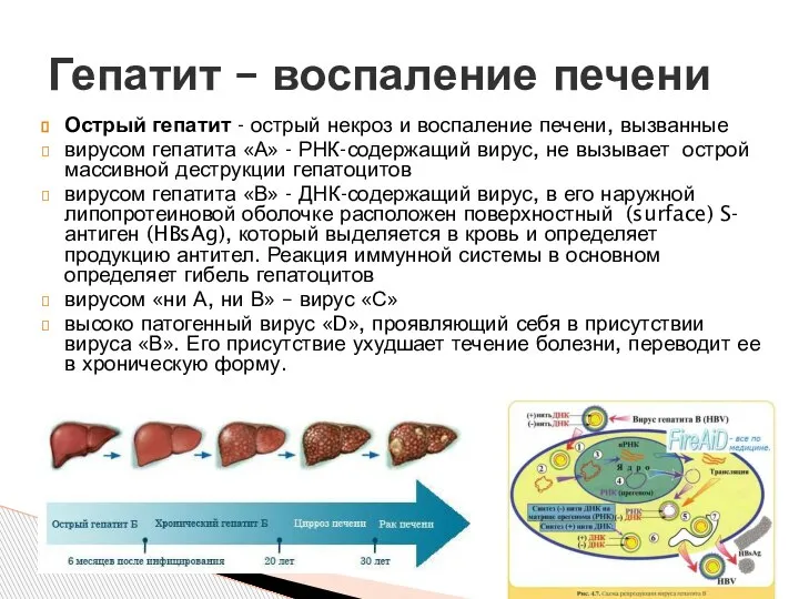 Острый гепатит - острый некроз и воспаление печени, вызванные вирусом гепатита «А»