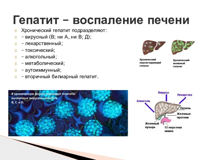 Хронический гепатит подразделяют: – вирусный (В; ни А, ни В; Д); –