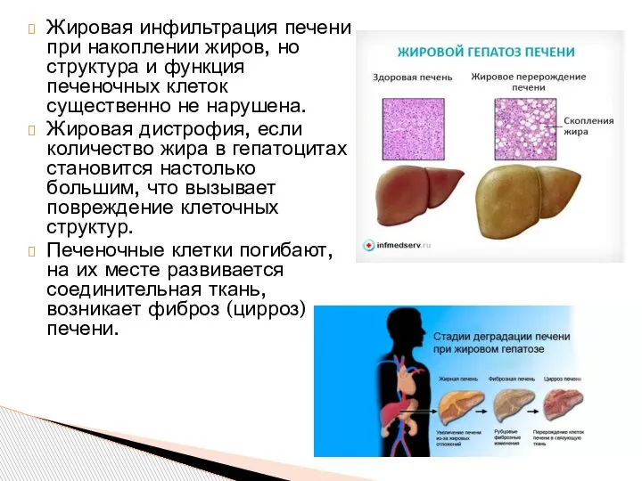 Жировая инфильтрация печени при накоплении жиров, но структура и функция печеночных клеток
