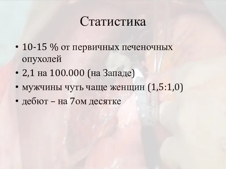 Статистика 10-15 % от первичных печеночных опухолей 2,1 на 100.000 (на Западе)