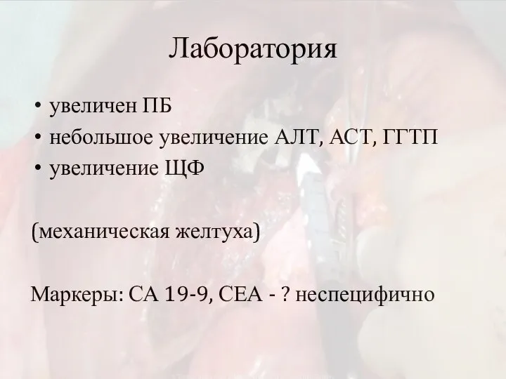 Лаборатория увеличен ПБ небольшое увеличение АЛТ, АСТ, ГГТП увеличение ЩФ (механическая желтуха)